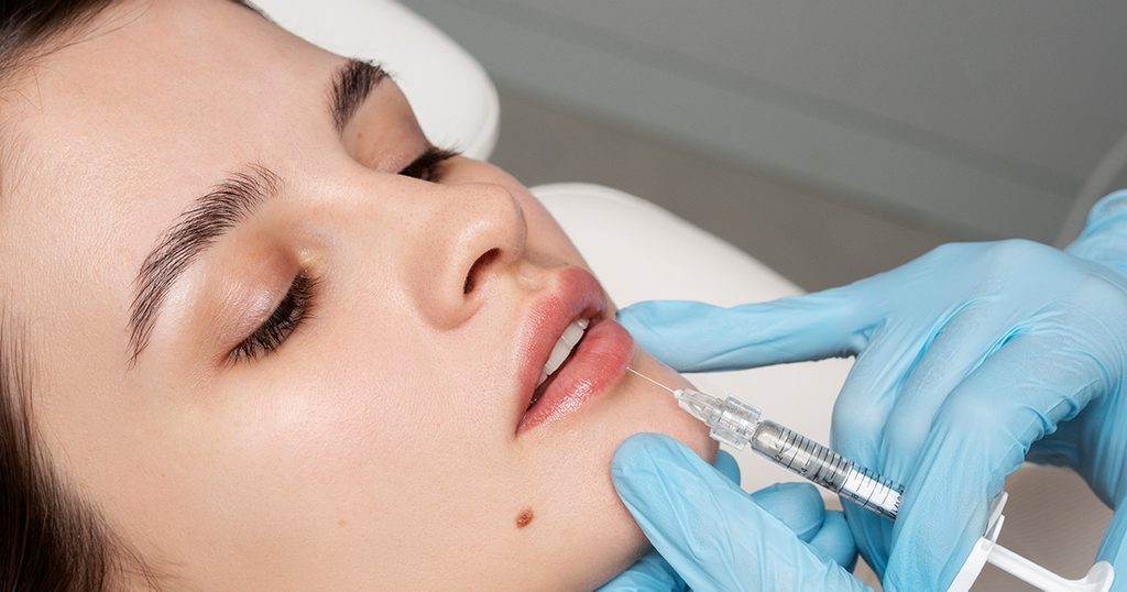 نصائح مهمة بعد فيلر الشفاه
