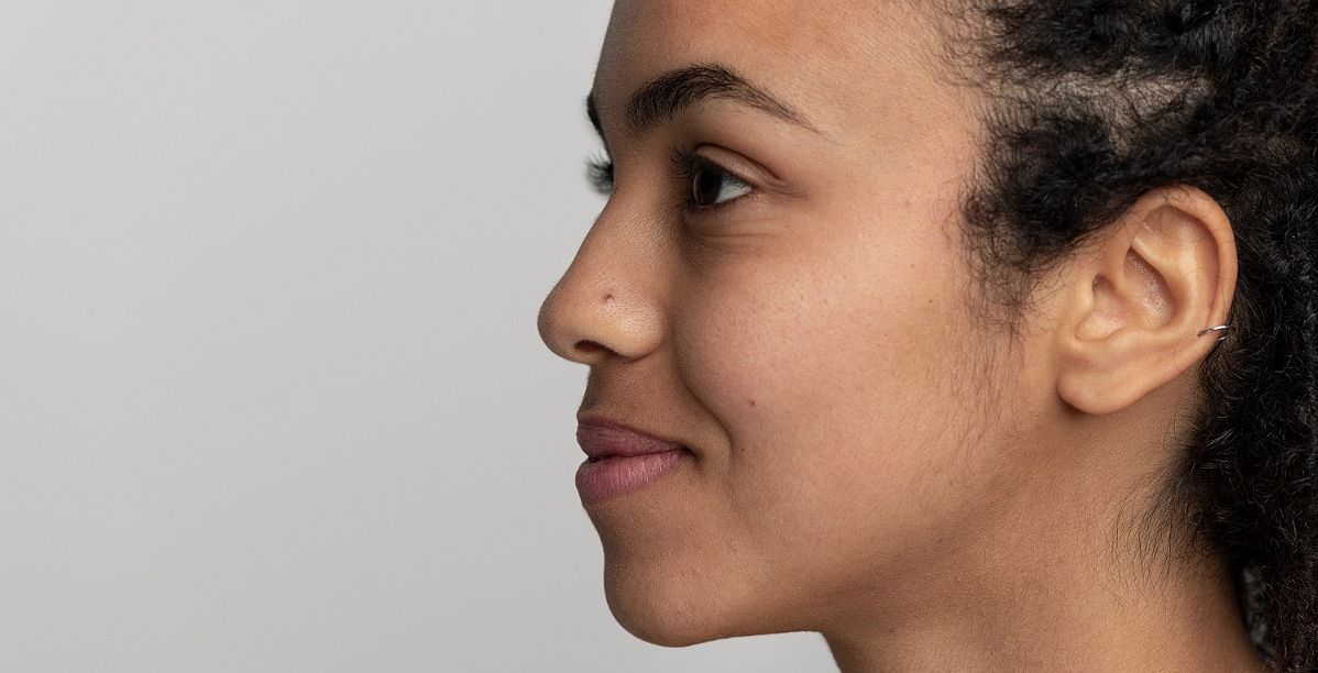 علاج نهائي للكلف العميق