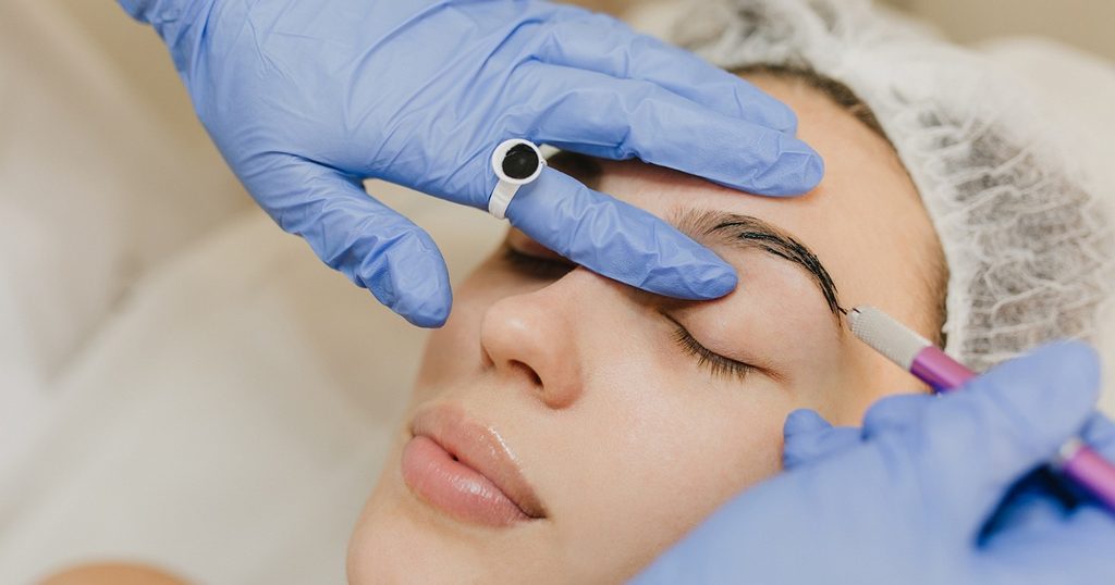 تشقير الحواجب بالليزر