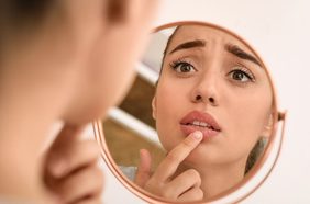 فيلر الشفايف