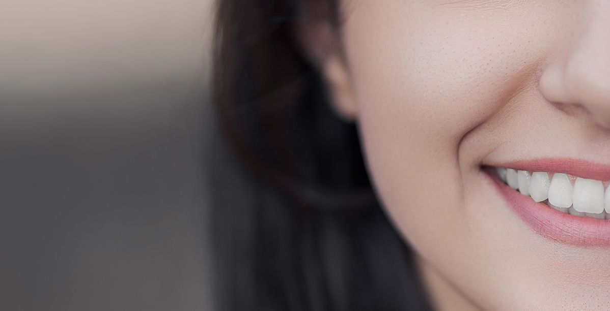 مشاكل تركيبات الاسنان الثابتة
