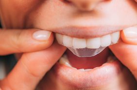 طريقة استخدام لصقات كرست