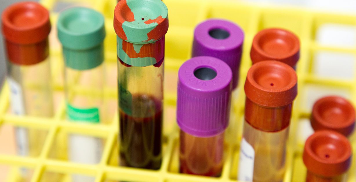 أشهر اضرار ابر الحديد