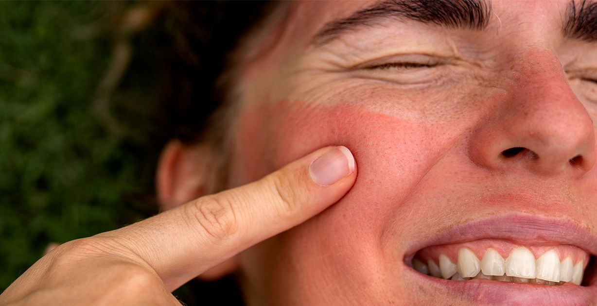 ما هي مدة شفاء جروح الوجه؟