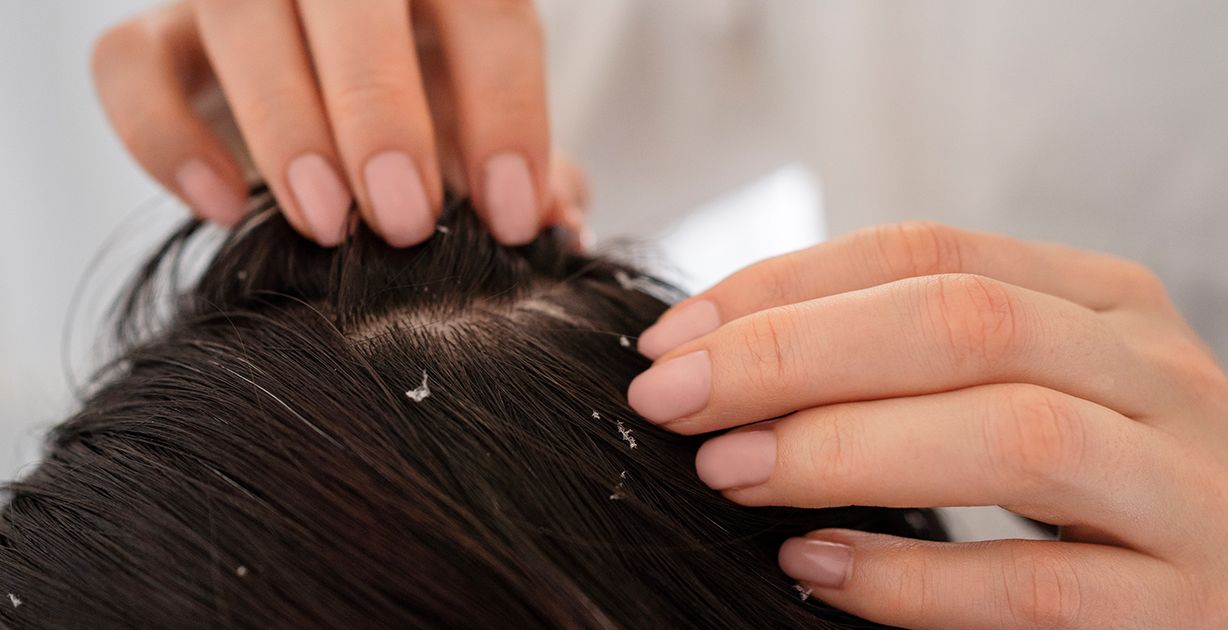 أشهر أسباب حكة الرأس والرقبة وعلاجها بسرعة