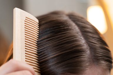 علاج كتل القشرة في الشعر