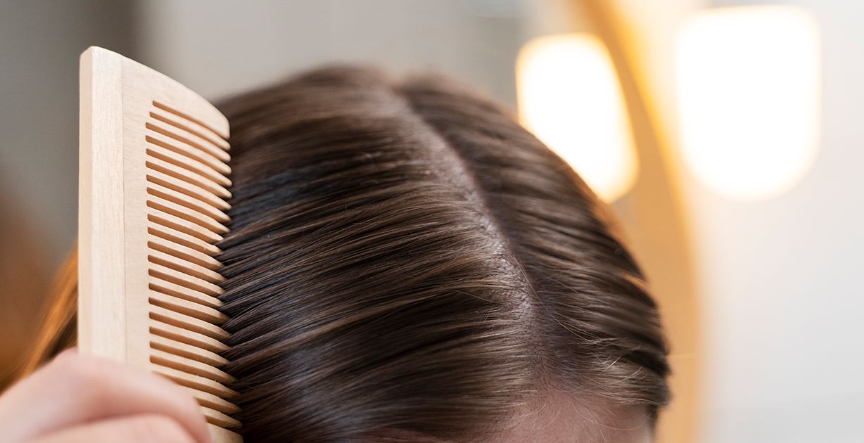 علاج كتل القشرة في الشعر