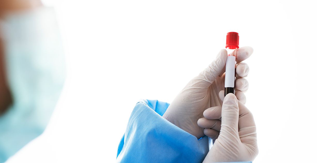 هل تحليل الدم يفطر الصائم؟
