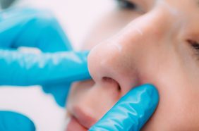 كم تستغرق مدة الشفاء من عملية تجميل الأنف؟ إليكِ التفاصيل