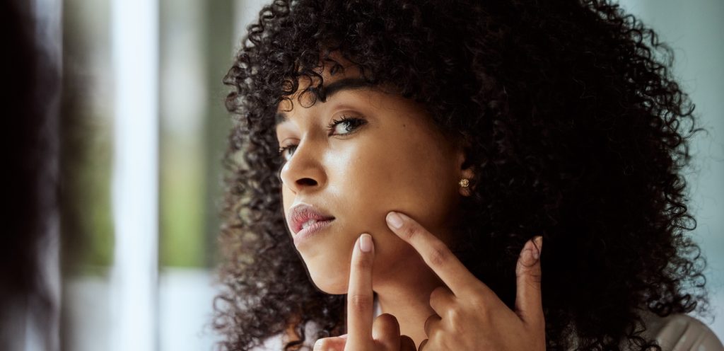 الرؤوس السوداء في الوجه