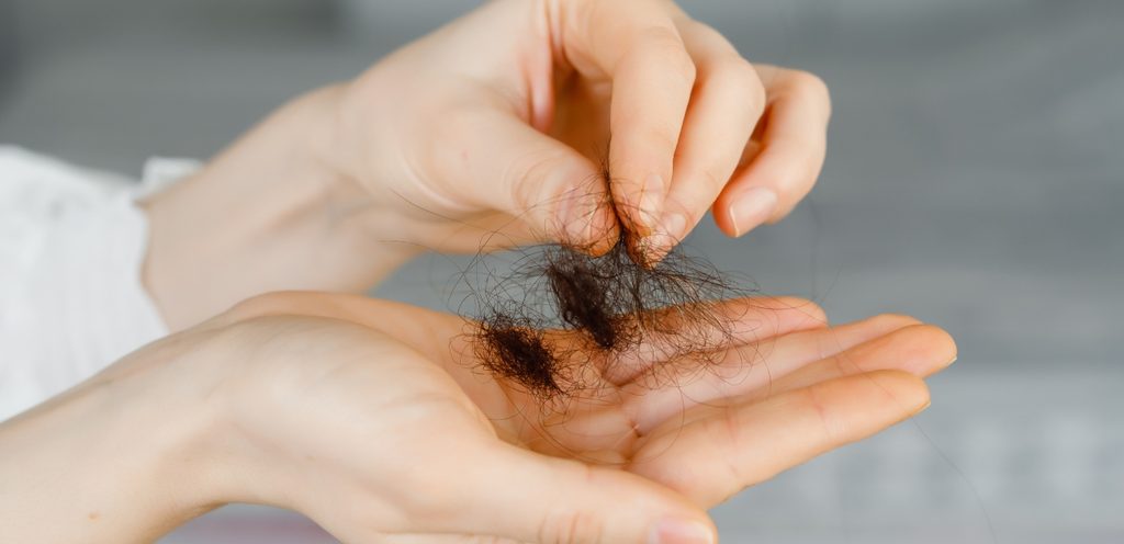 مشكلة تساقط الشعر