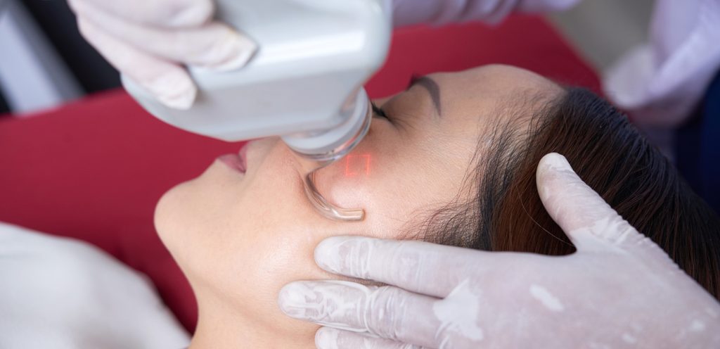 أضرار الليزر للوجه في الصيف