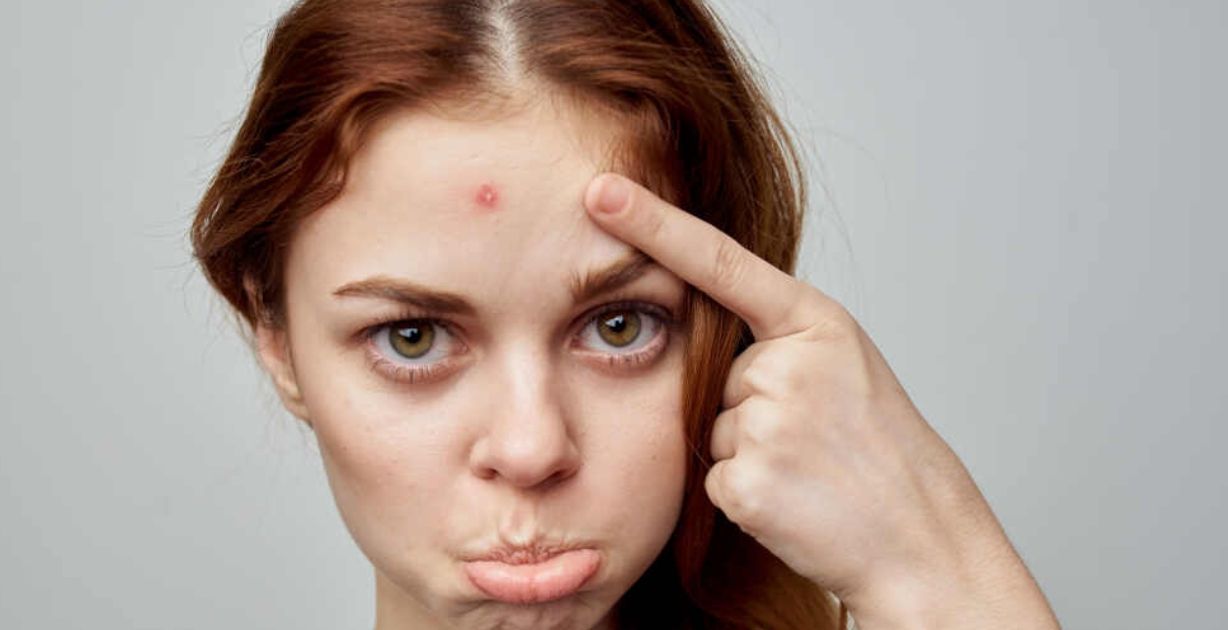 حساسية الوجه​: ما أنواعها أسبابها وأعراضها؟