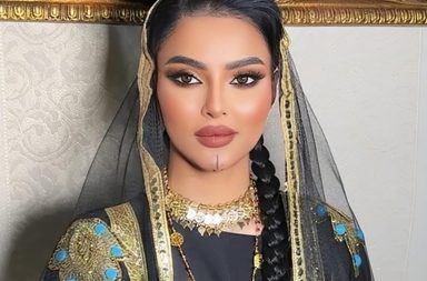 تشوه في الوجه قد يبعد رومي القحطاني عن مسابقة "ملكة جمال المرأة العالمية"!