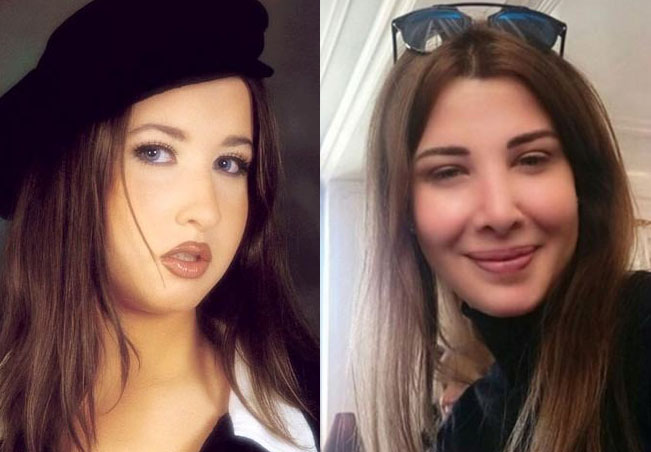 صور نجمات لم يظهرن أبدا من دون ماكياج قبل عمليات التجميل