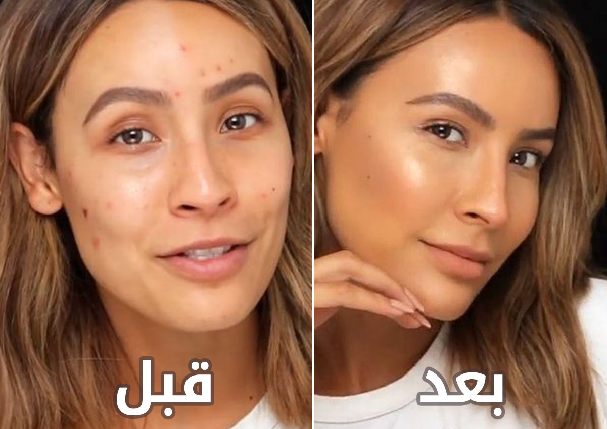 اليك حيلة الماكياج الذكية التي طبقتها هذه المدونة لإخفاء حبّ الشباب نهائياً