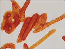 علماء أمريكيون متفائلون بإنتاج علاج للإيبولا Ebola