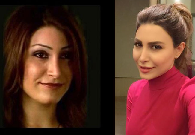 صور نجمات لم يظهرن أبدا من دون ماكياج قبل عمليات التجميل