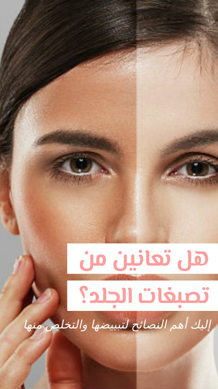 Story هل تعانين من تصبغات الجلد؟