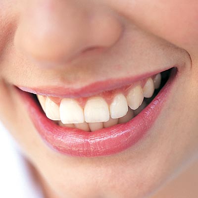 كيف تتخلصين من اصفرار اسنانك؟