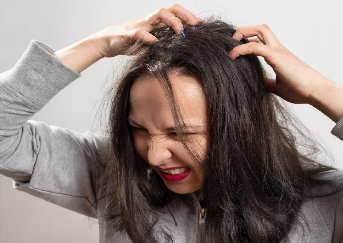 كيف اتخلص من الصيبان العالق بالشعر