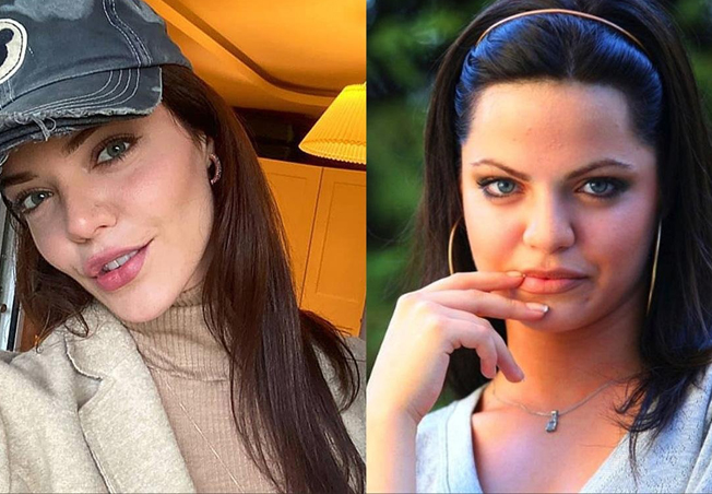 بطلة مرارة الحب قبل عمليات التجميل