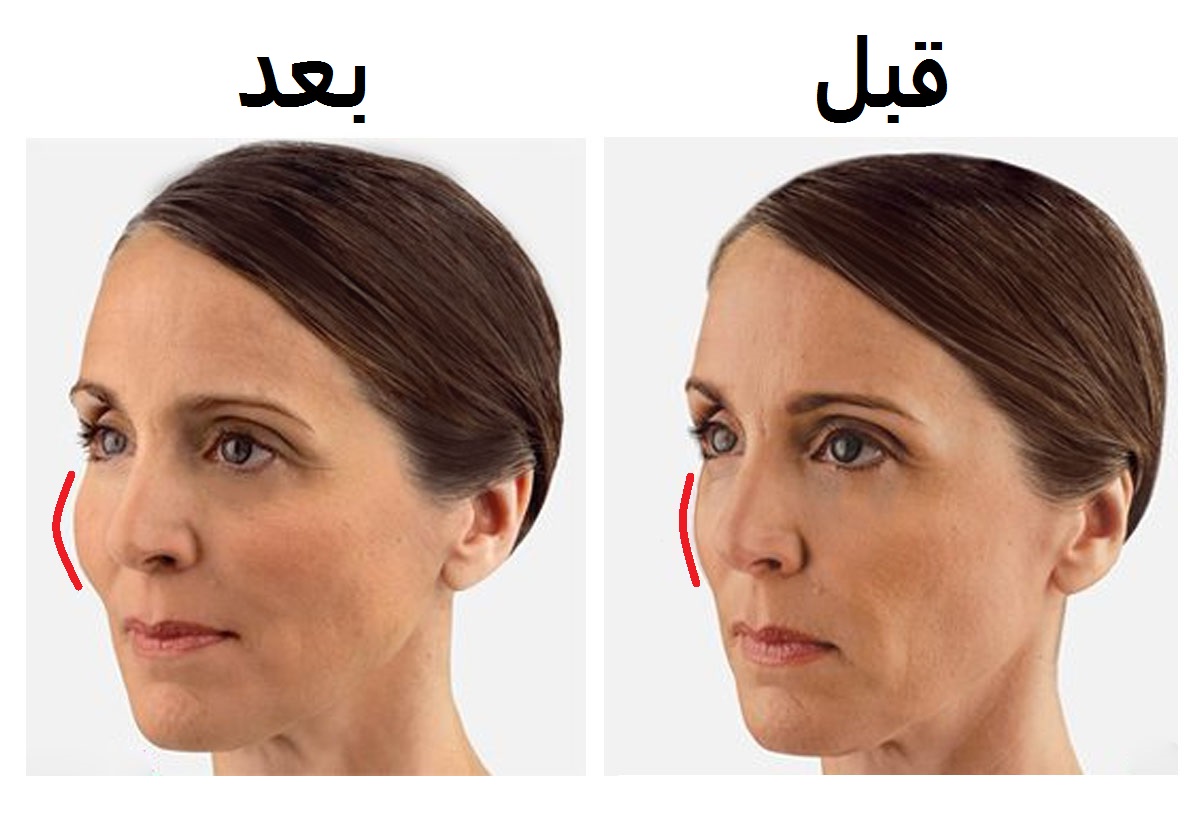 بمكونين من مطبخك تحصلين على خدود مشدودة ومنتفخة خلال 10 دقائق.. تأثيرهما كالبوتوكس!