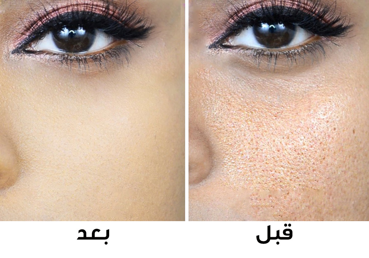 هكذا تتخلصين من المسام الواسعة بنصف ساعة!
