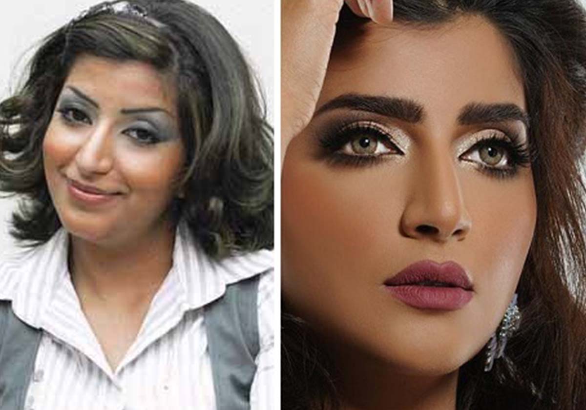 بثينة الرئيسي قبل التجميل وبعده
