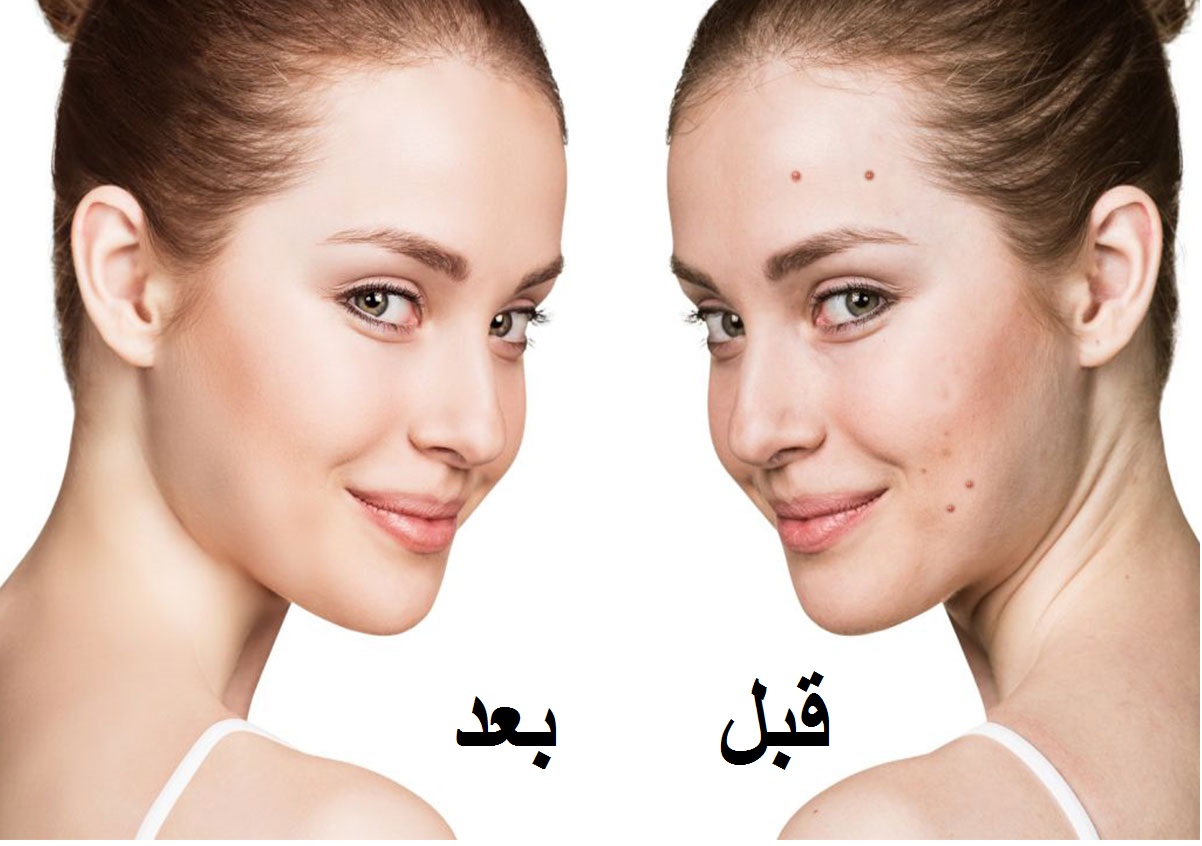 وضعت قناع الفيكس على وجهها وبعد 15 دقيقة حدث ما لم يكن متوقعاً!