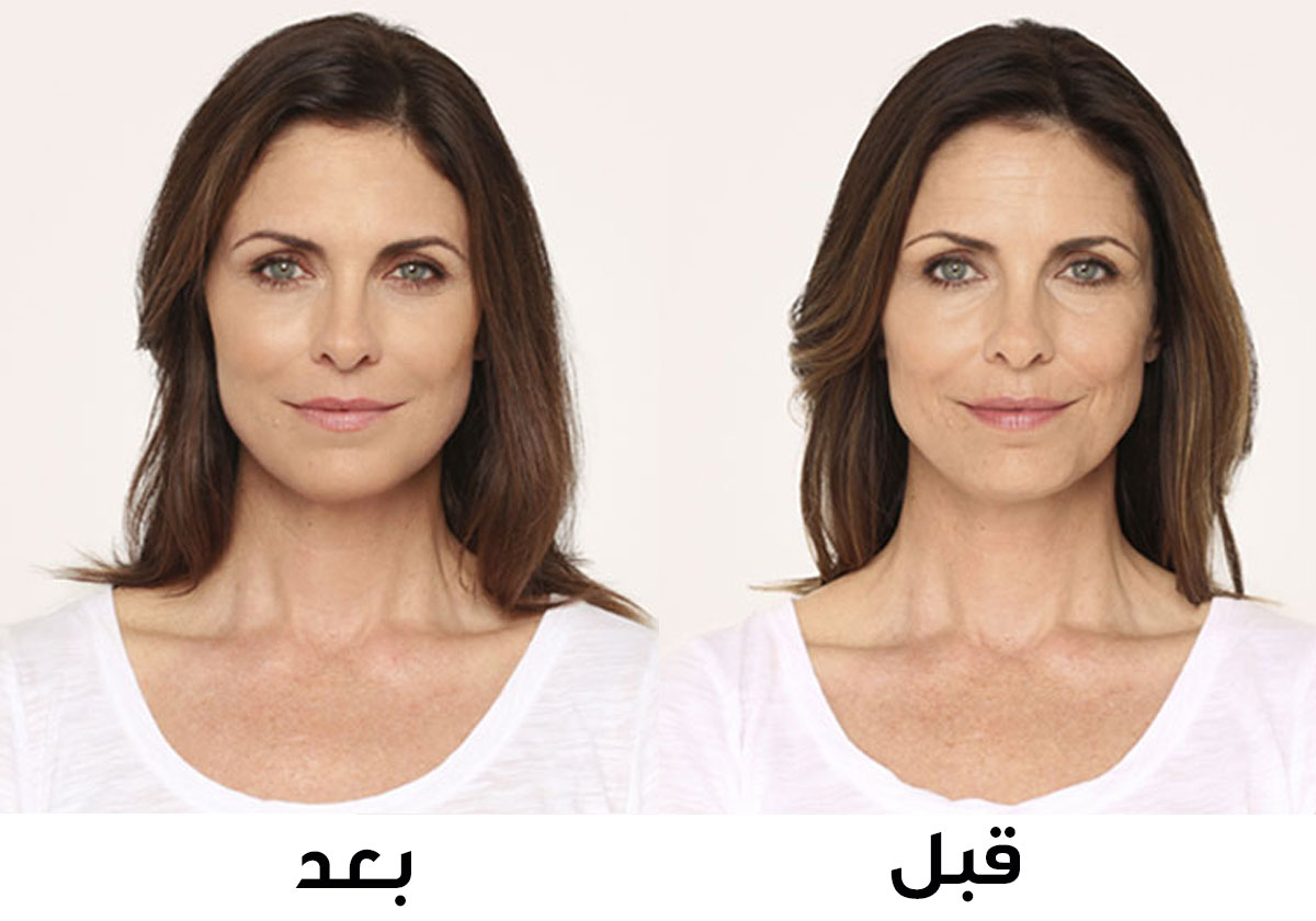 لبان الذكر للتجاعيد