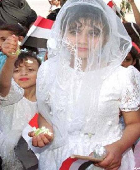 ليلة دخلة الطفلة اليمنية تحولت إلى مأتم