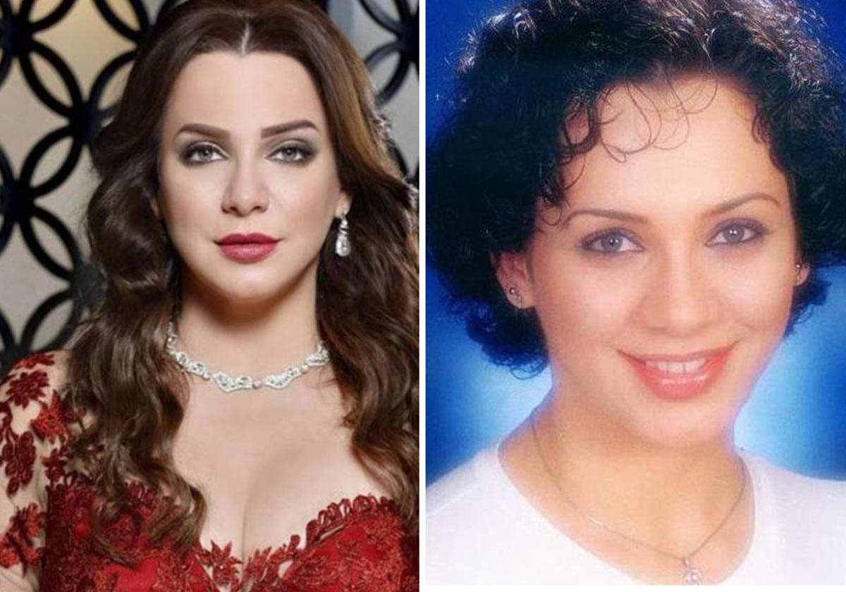 بالصور، نجمات الدراما السورية قبل عمليات التجميل وبعدها