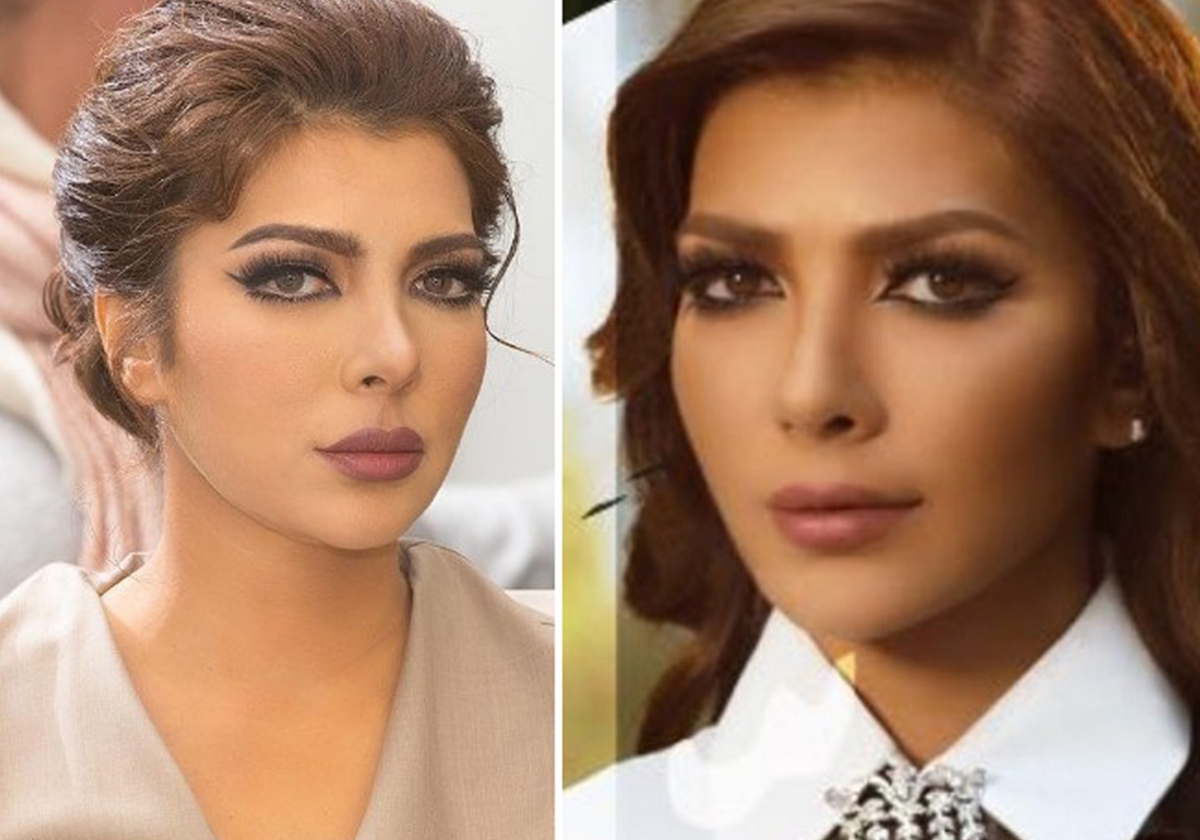 أحدث صورة لأصالة...هل أجرت عملية تجميل جديدة؟ 