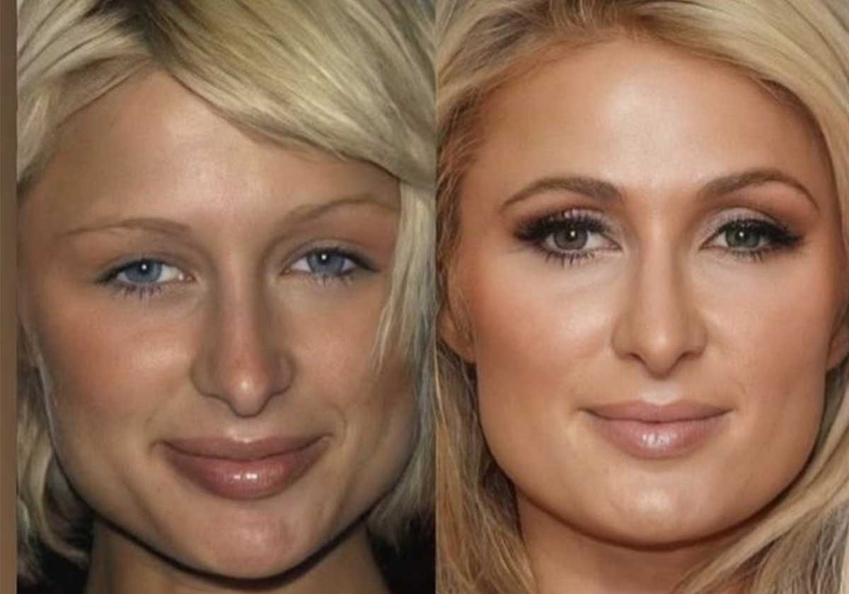 صور من مراهقة النجمات تظهر التغير الذي سببته عمليات التجميل