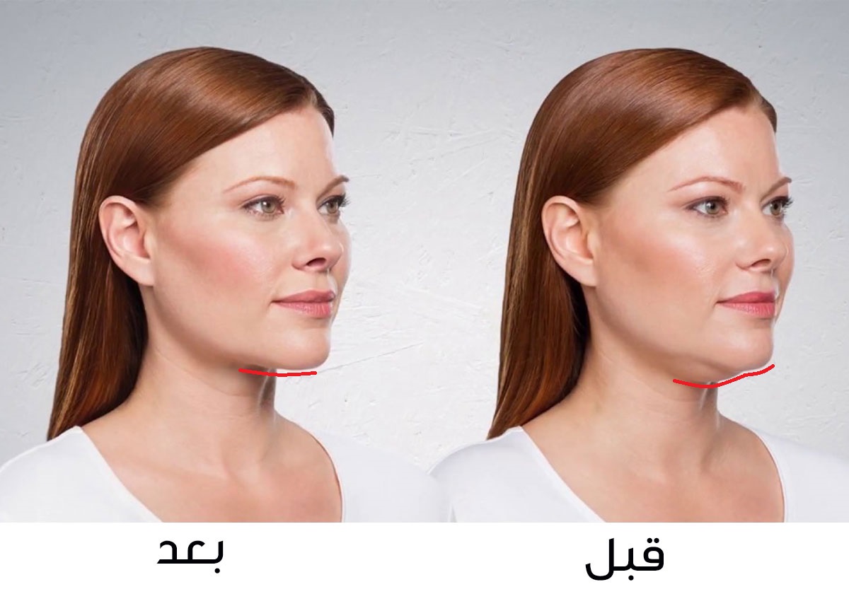 وصفة بياض البيض المذهلة تخلصك من الذقن المزدوج خلال أيام!