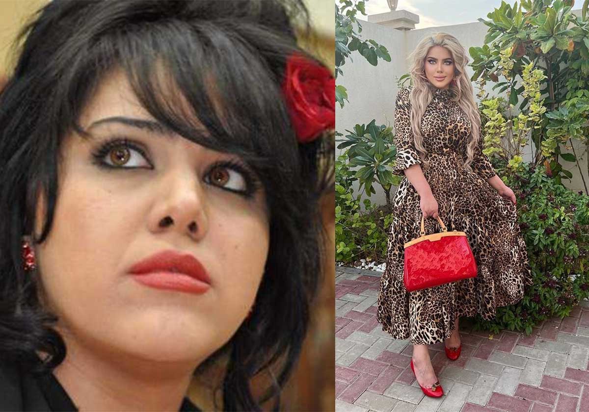 مروة راتب قبل وبعد التجميل