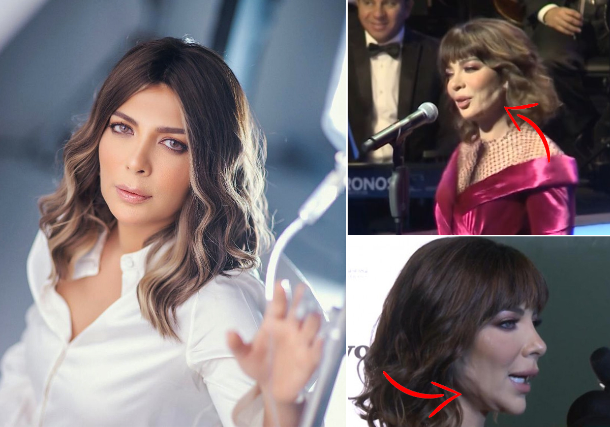 ما هي النتوءات الغريبة التي ظهرت على وجه أصالة!؟