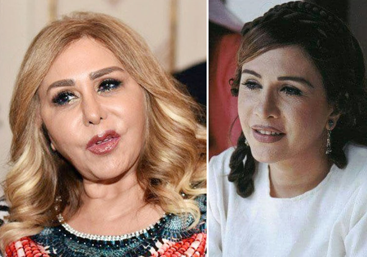 نجمات سوريا وعمليات التجميل: ناجحة عند البعض وتشوهات مخيفة عند البعض الآخر..إليك الصور: