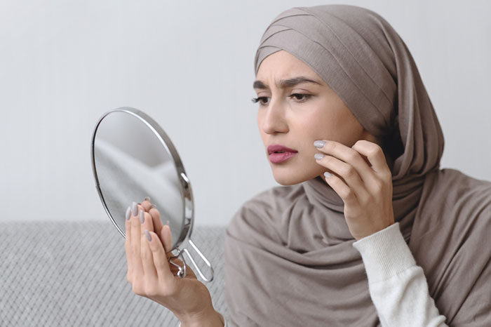 أسباب تعزز ظهور البثور وحب الشباب عليك تجنبها