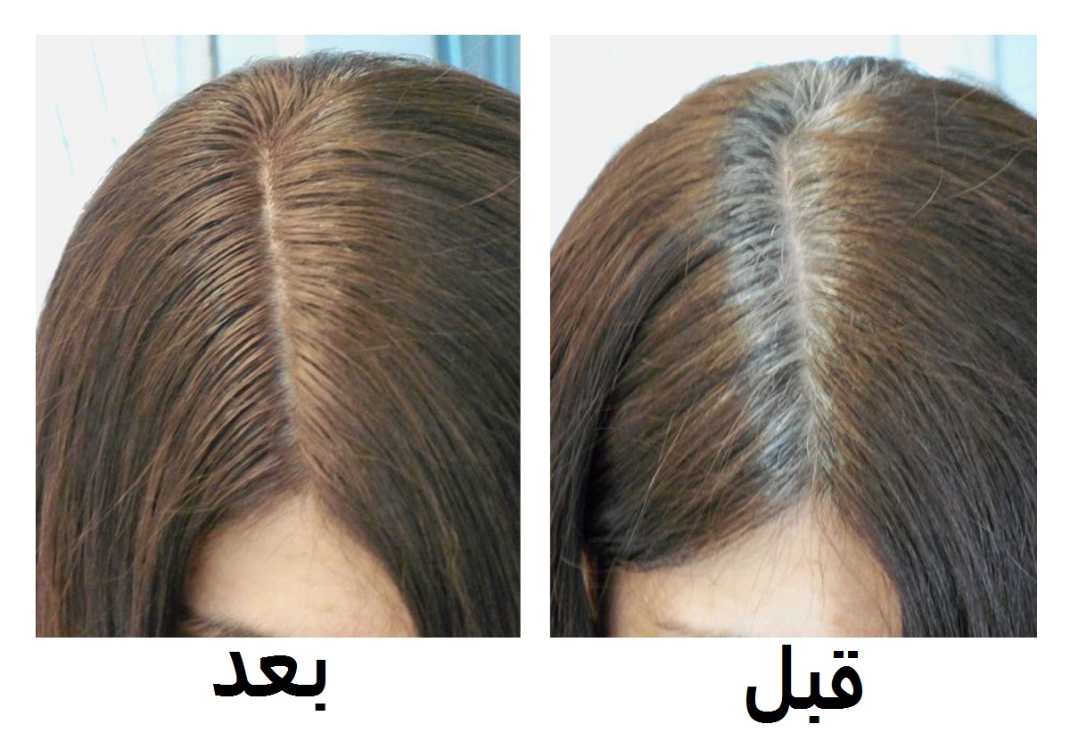 وصفة سحرية تقضي على الشيب وتغنيك عن الصبغة لأكثر من سنة!