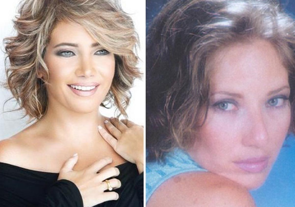 سلافة معمار قبل التجميل وبعده