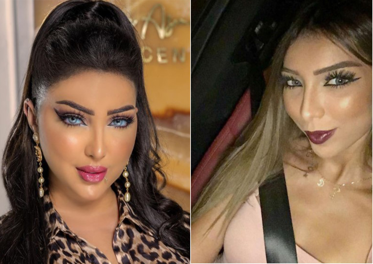 نجمات بالغن في عمليات التجميل وأفسدن شكلهن