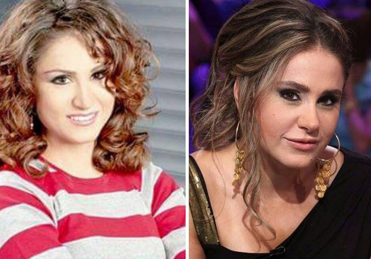 ديمة قندلفت قبل التجميل وبعده