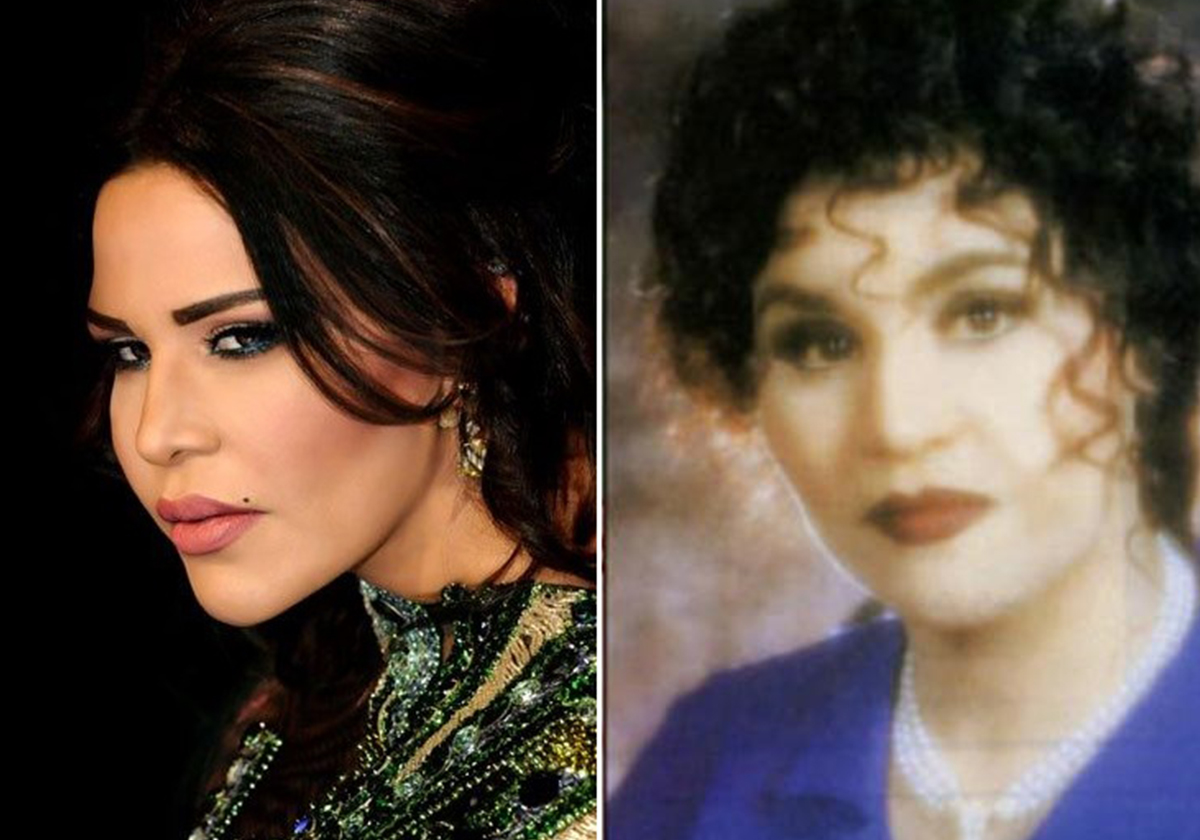 تغييرات مذهلة في صور نجمات الخليج بعد عمليات التجميل
