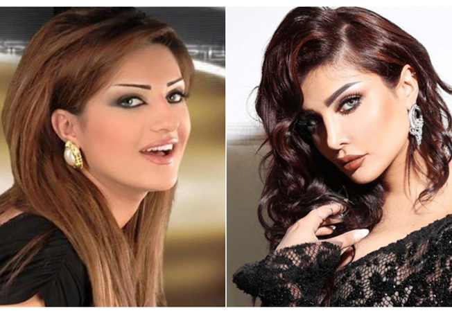 أمل العوضي قبل عمليات التجميل