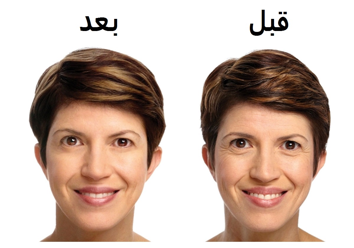بمكونات منزلية حضري مشروب الكولاجين السحري واعيدي الشباب الى بشرتك على الفور!