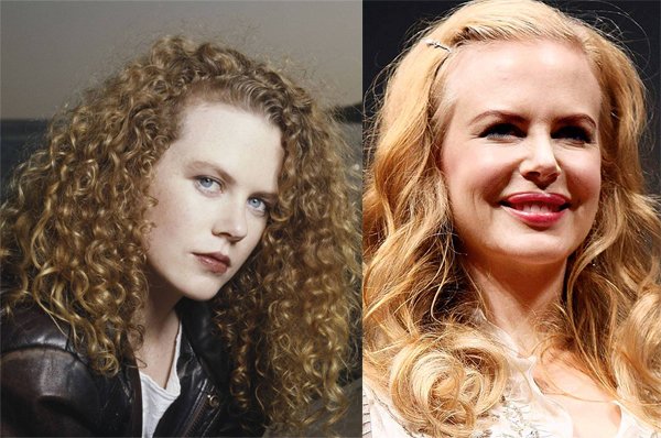 الفنانات قبل وبعد التجميل | عمليّات تجميل فاشلة للفنانات