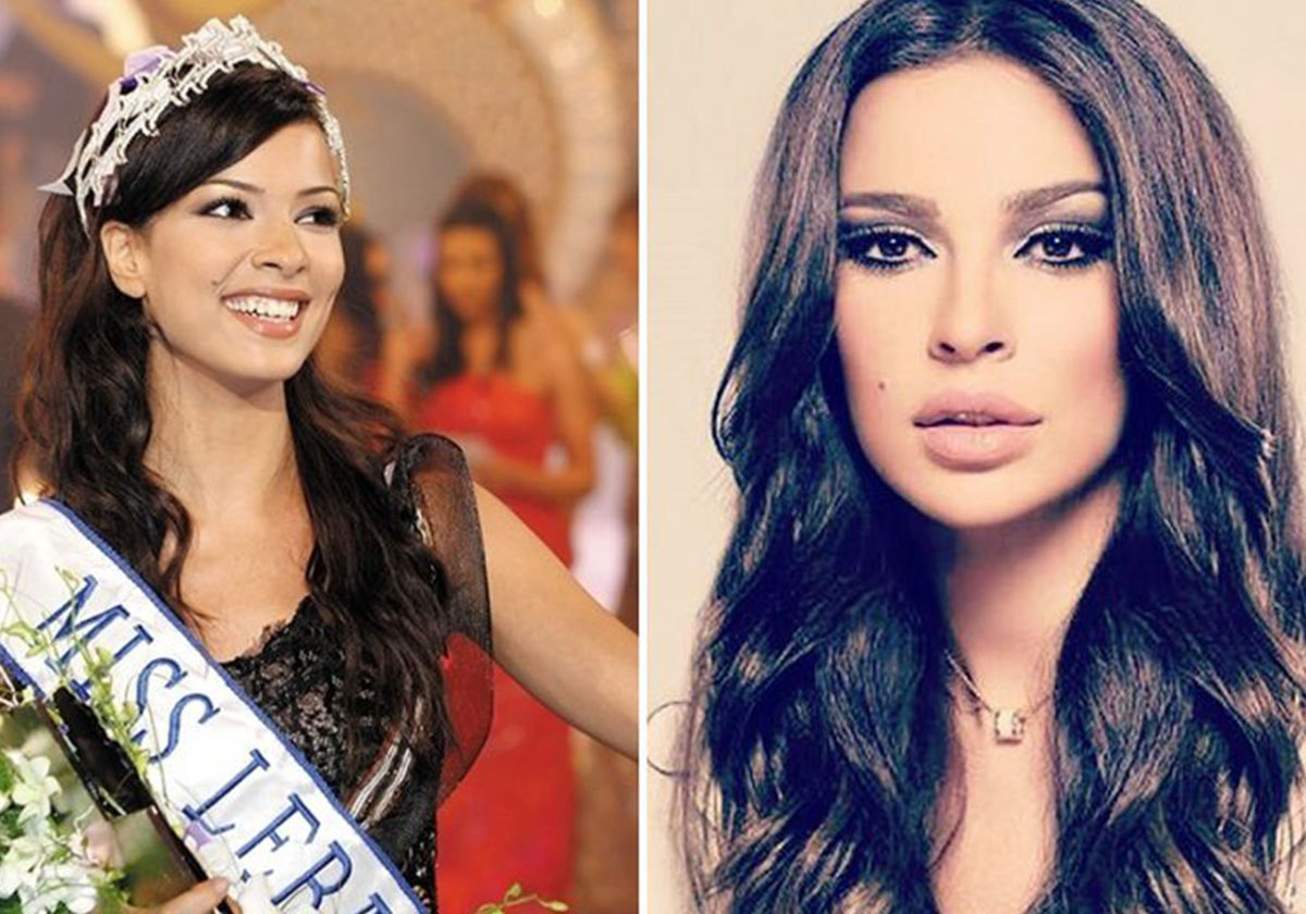 صور صادمة للنجمات العربيّات قبل عمليات تكبير الشفاه وبعدها!