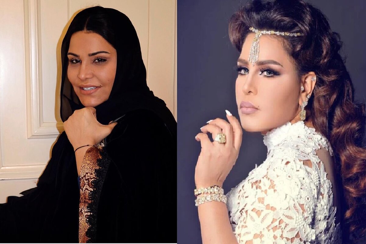 حقن البلازما للوجه قبل وبعد
